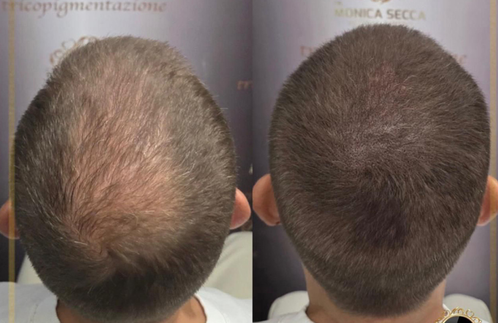 trico_densita_mazo_2026