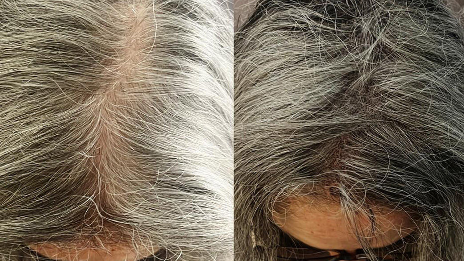 trico_effetto_densita_infoltimento_donna